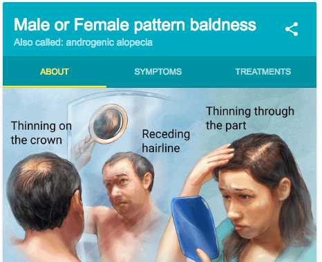 both a male and a female both experiencing male patterned baldness.