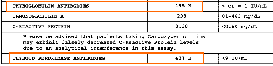 thyroid lab tests from a patient with hashimoto's showing elevated thyroglobulin and thyroid peroxidase antibodies.
