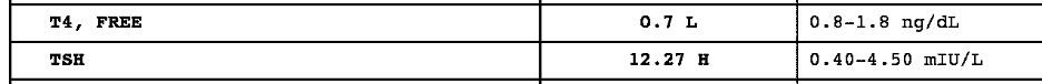 high-free-t4-and-low-tsh-in-hashimotos High free T4 and low TSH in hashimoto's