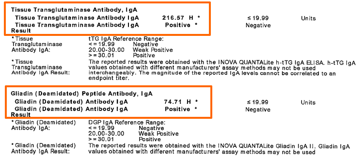 Dave's lab tests showing an elevated tissue transglutaminase and gliadin deamidated antibody iga.