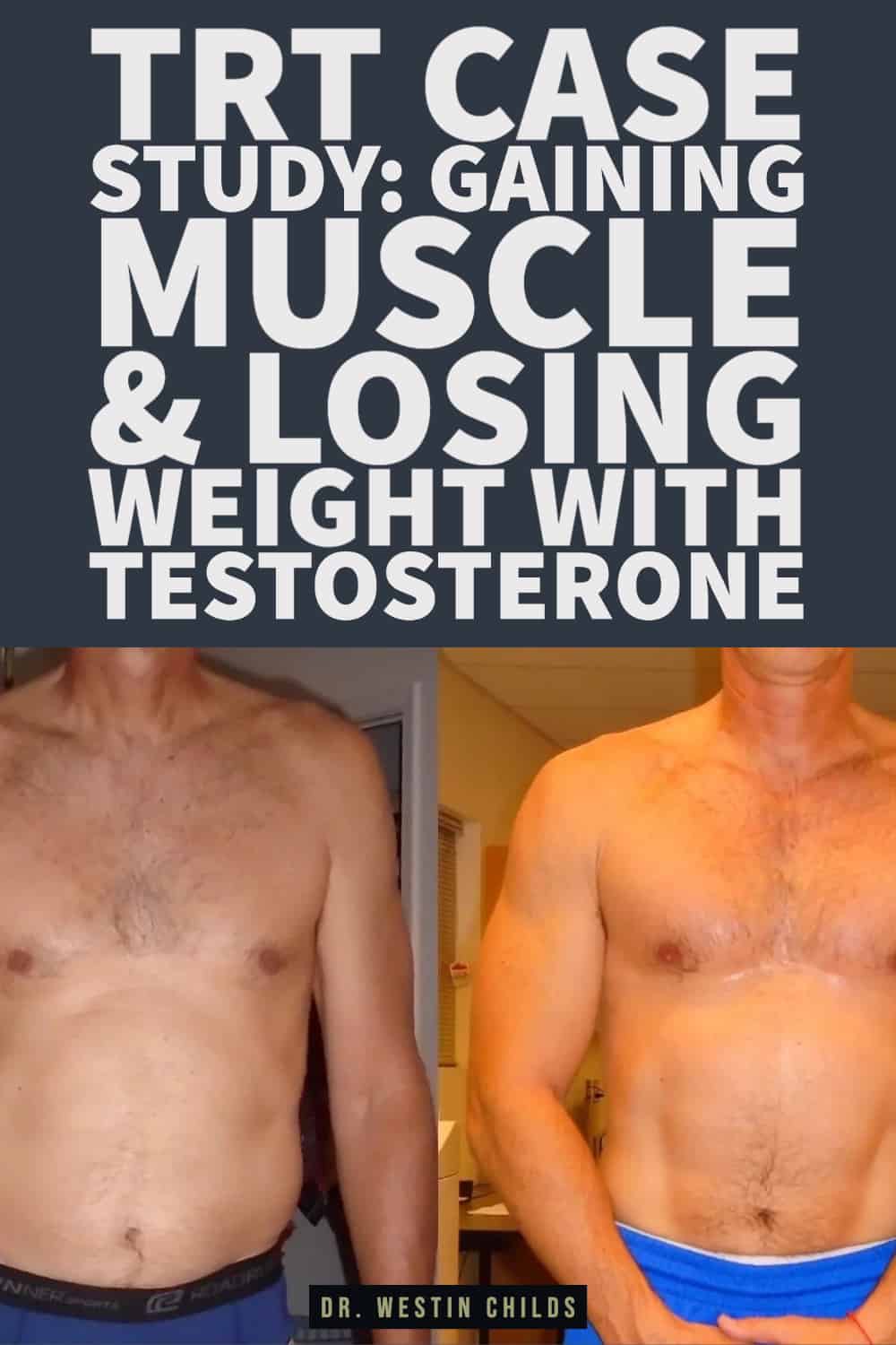 trt case study_ gaining muscle & losing weight with testosterone-1 trt case study gaining muscle & losing weight with testosterone