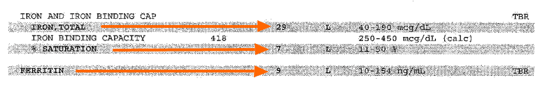 lab tests showing a low total iron, a low percent saturation, and a low ferritin in a patient.