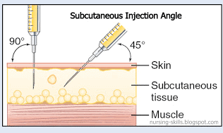 diagram which shows how to give a subcutaneous injection at the correct depth.