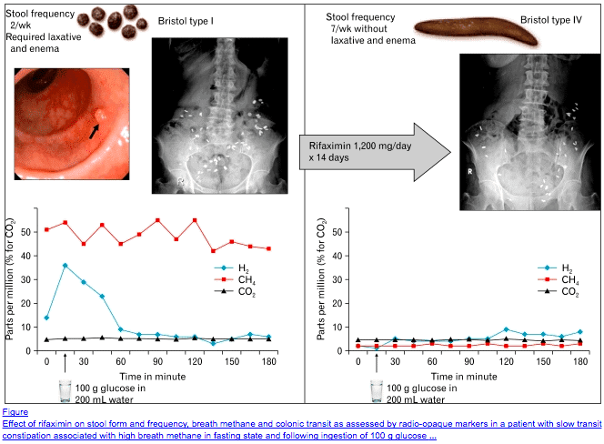 two graphs showing the effect of rifaximin on stool form and frequency as well as corresponding methane levels.