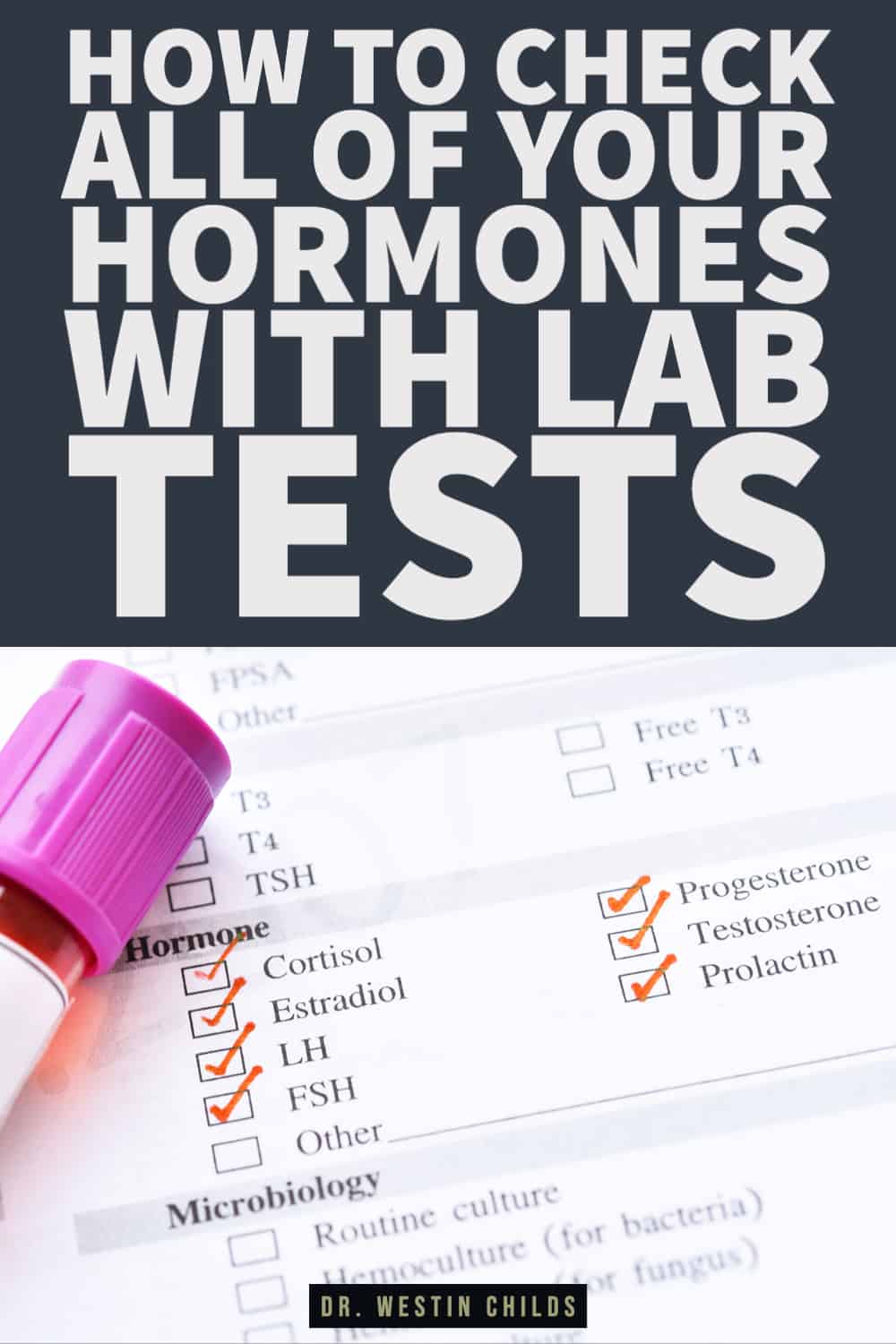 How to check all of your hormones with lab tests-1 How to check all of your hormones with lab tests