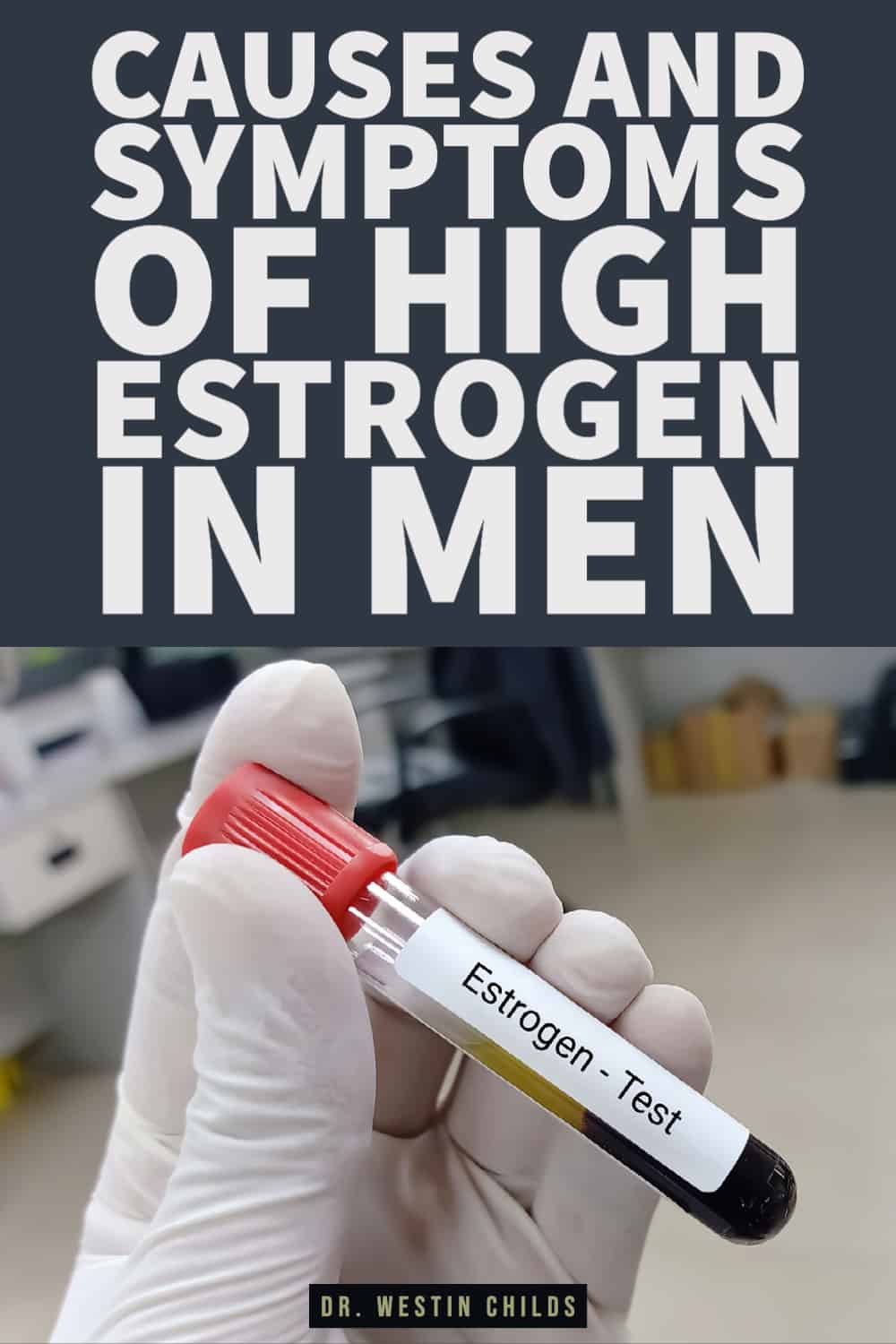causes and symptoms of high estrogen in men-1 causes and symptoms of high estrogen in men