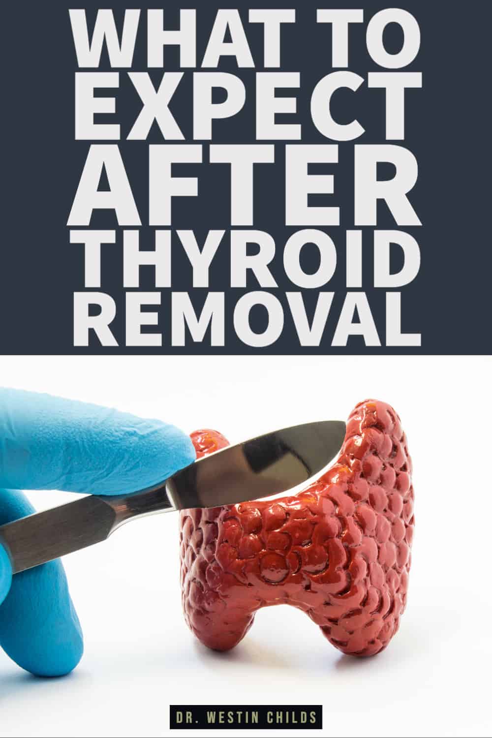 what to expect after thyroid removal-1 what to expect after thyroid removal