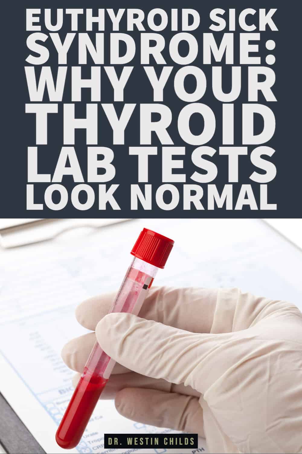euthyroid sick syndrome_ why your thyroid lab tests look normal-1 euthyroid sick syndrome why your thyroid lab tests look normal