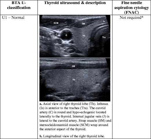 picture of thyroid cyst on ultrasound imaging picture of thyroid cyst on ultrasound imaging