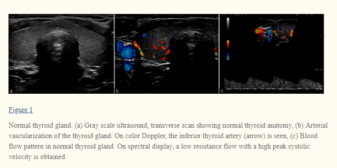 what your thyroid gland looks like during ultrasound testing what your thyroid gland looks like during ultrasound testing