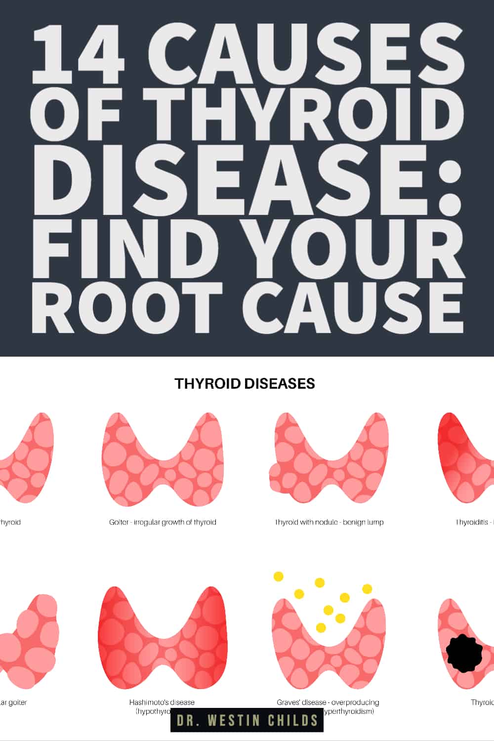 14 causes of thyroid disease_ find your root cause-1 14 causes of thyroid disease: find your root cause