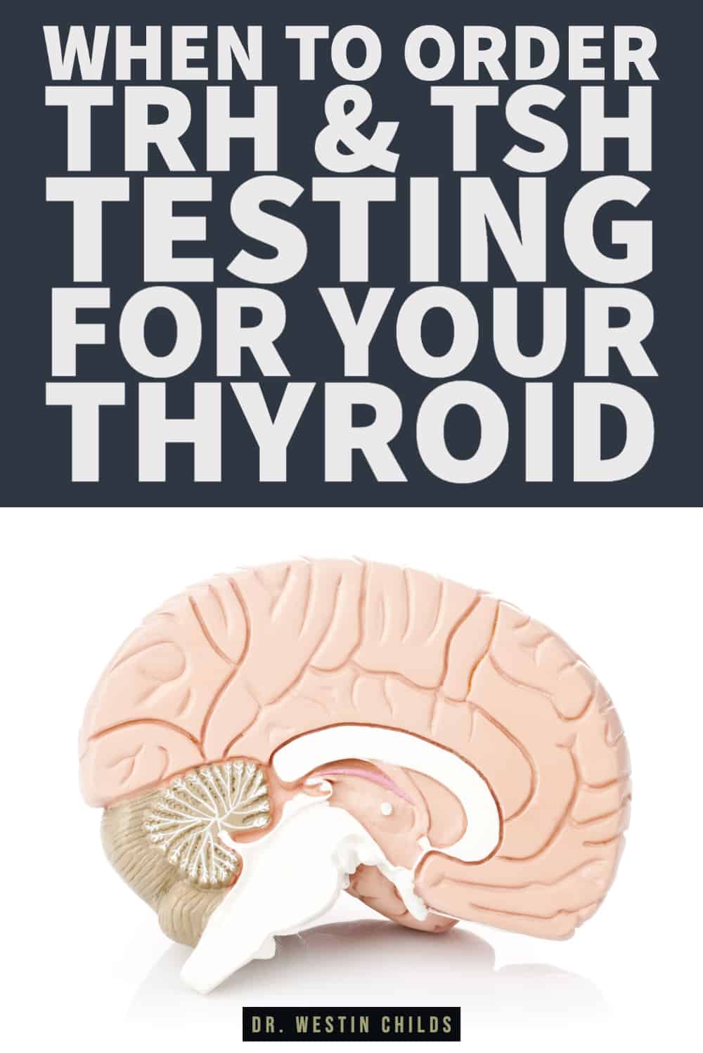 when to order TRH & TSH testing for your thyroid-1 when to order TRH & TSH testing for your thyroid
