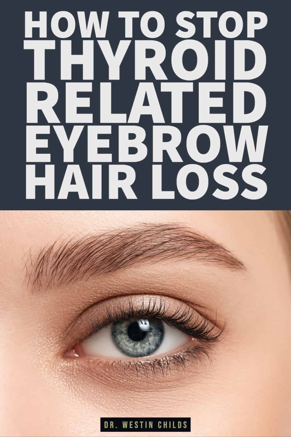how to stop thyroid related eyebrow hair loss-1 how to stop thyroid related eyebrow hair loss