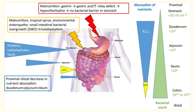 how malnutrition and low stomac acid impact gut health how malnutrition and low stomac acid impact gut health