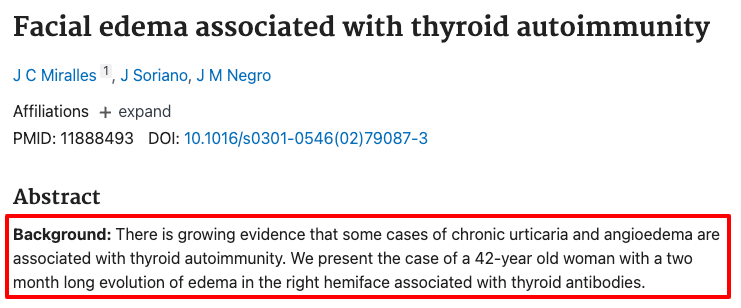hypothyroidism is associated with angioedema and facial swelling hypothyroidism is associated with angioedema and facial swelling