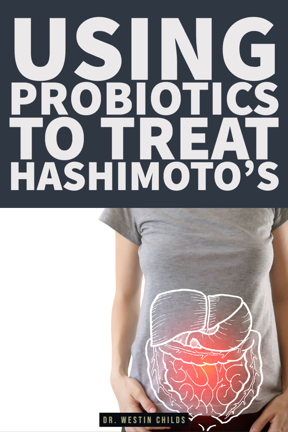using probiotics to treat hashimoto’s-1 using probiotics to treat hashimoto’s