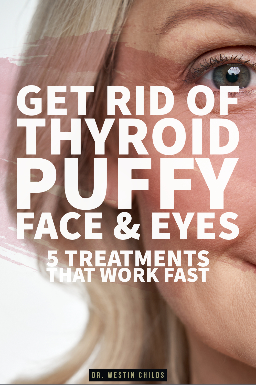 5 treatments to get rid of thyroid puffy face and eyes 5 treatments to get rid of thyroid puffy face and eyes