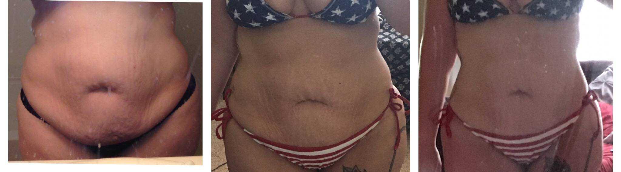 3 pictures of melanie showing her weight loss progress over time.