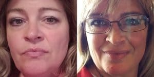 Adding t3 to NDT for weight loss and energy