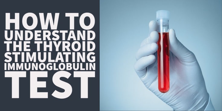 Thyroid Stimulating Immunoglobulin (TSI): What High Levels Mean