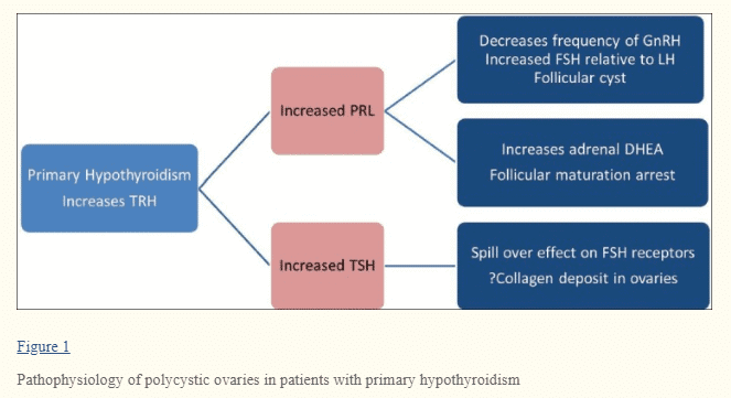 hypothyroidism and PCOS hypothyroidism and PCOS