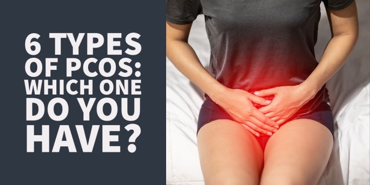 Types and Causes of PCOS (6 You Should Be Aware of)
