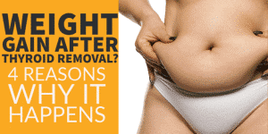 weight gain after thyroid removal? Here's why
