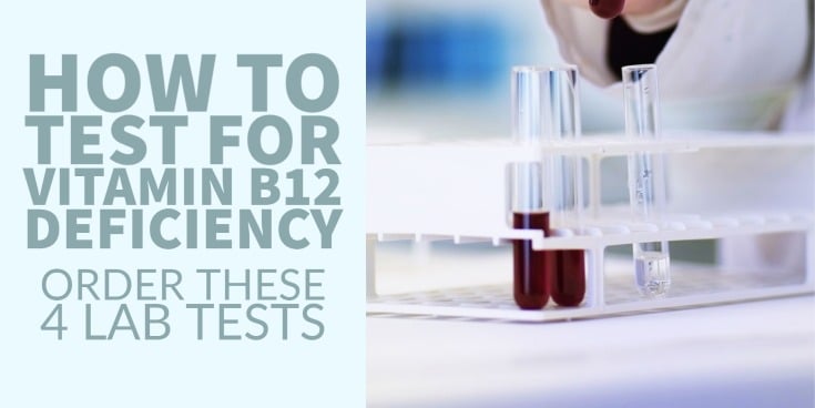 How to Test for Vitamin B12 Deficiency (Order These 4 Lab Tests)
