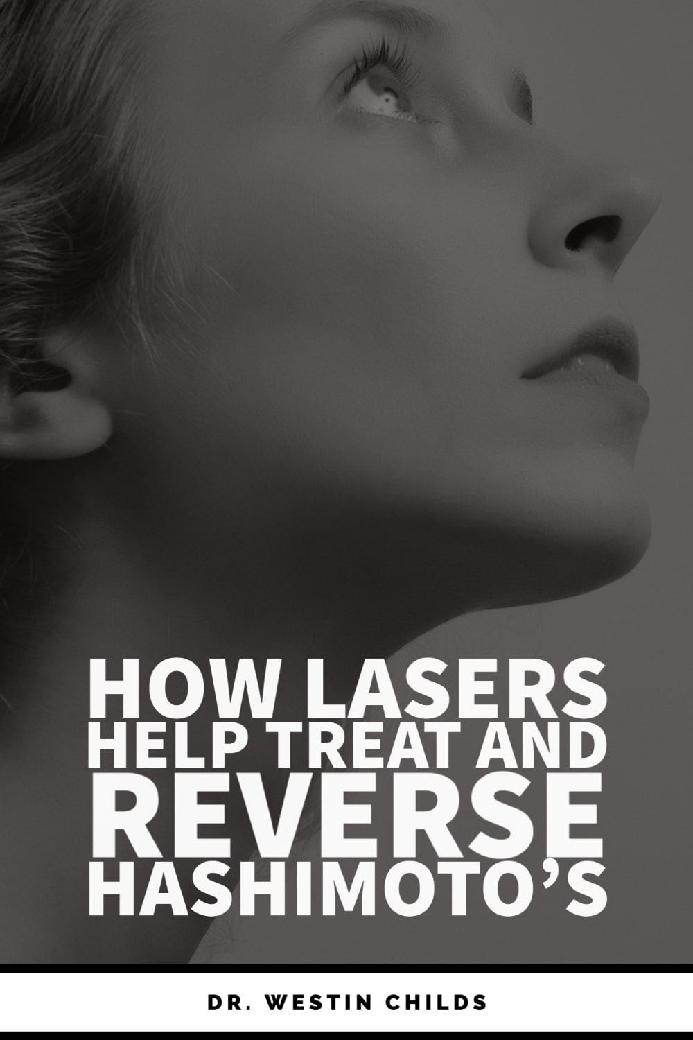 Can lasers treat and reverse hashimoto's thyroiditis? Can lasers treat and reverse hashimoto's thyroiditis?