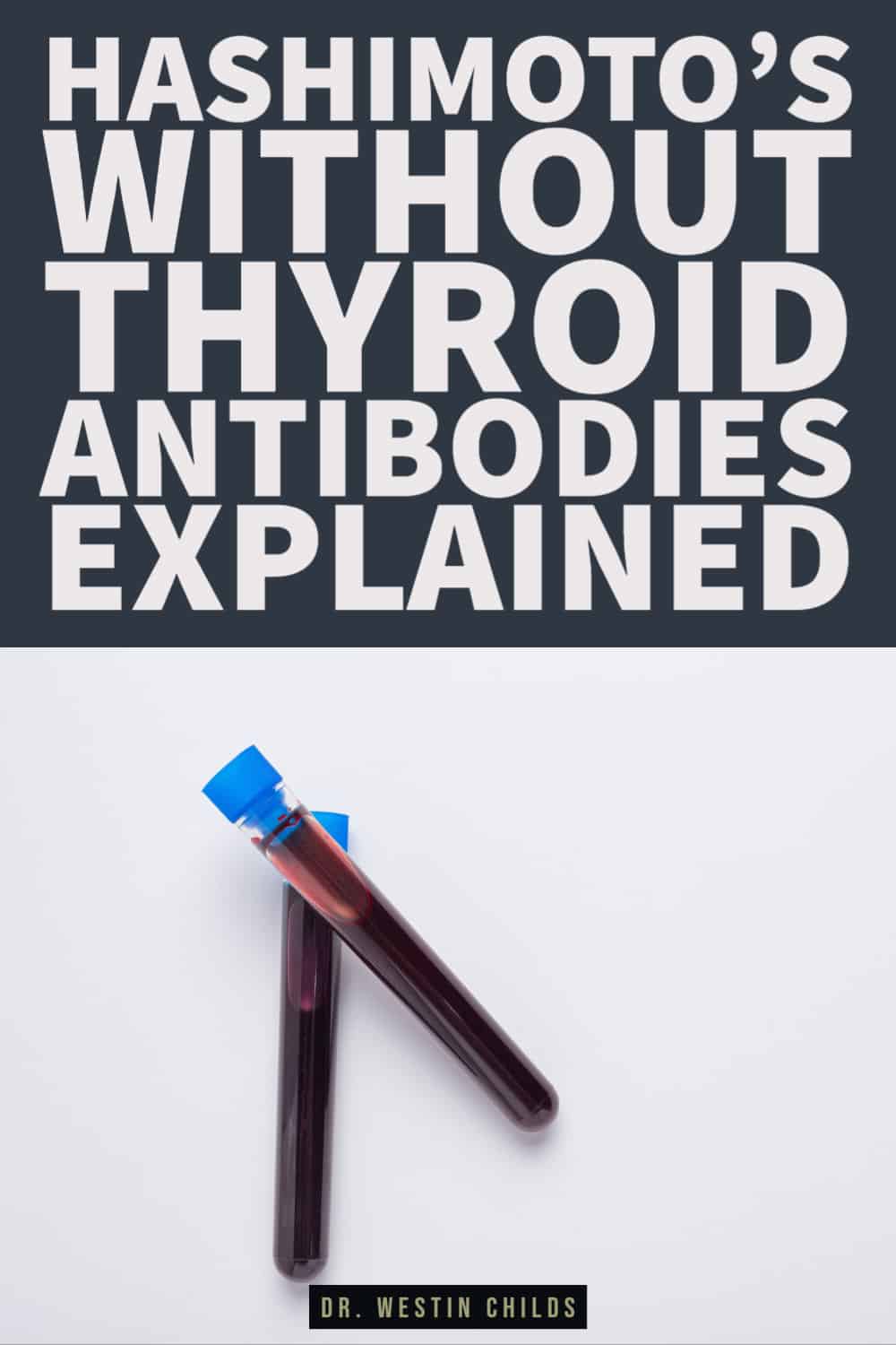 conditions that cause hashimoto's without thyroid antibodies conditions that cause hashimoto's without thyroid antibodies