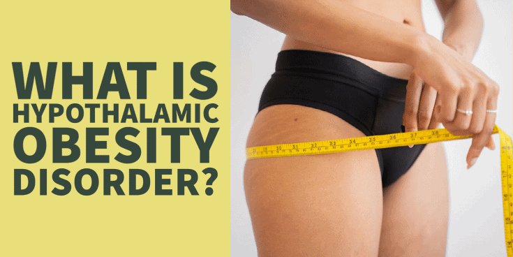 Is Hypothalamic Obesity Disorder Causing your Thyroid Symptoms?