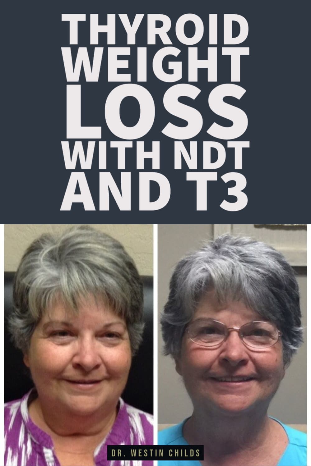 thyroid weight loss with NDT and T3 thyroid weight loss with NDT and T3 pinterest image.