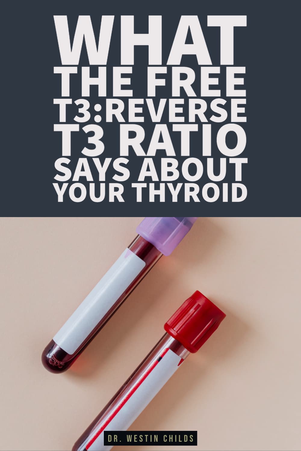 what the free t3 reverse t3 ratio says about your thyroid what the free t3 reverse t3 ratio says about your thyroid