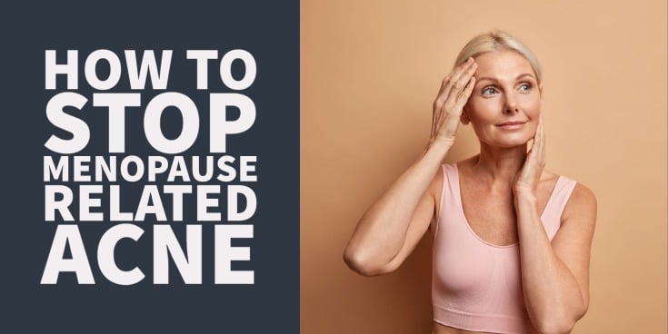How to Treat (& Stop) Menopause Related Acne