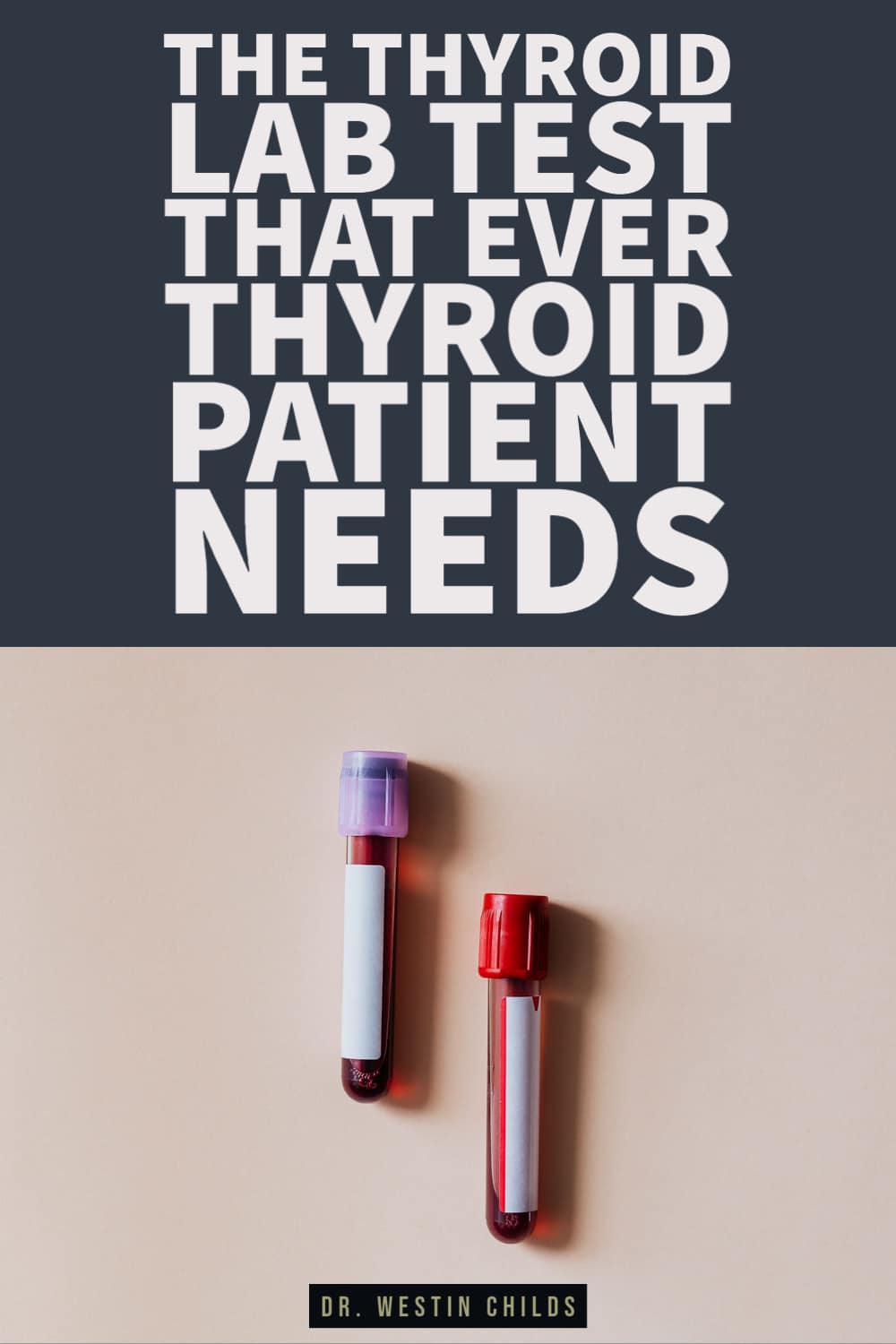 the thyroid lab test that ever thyroid patient needs the thyroid lab test that ever thyroid patient needs