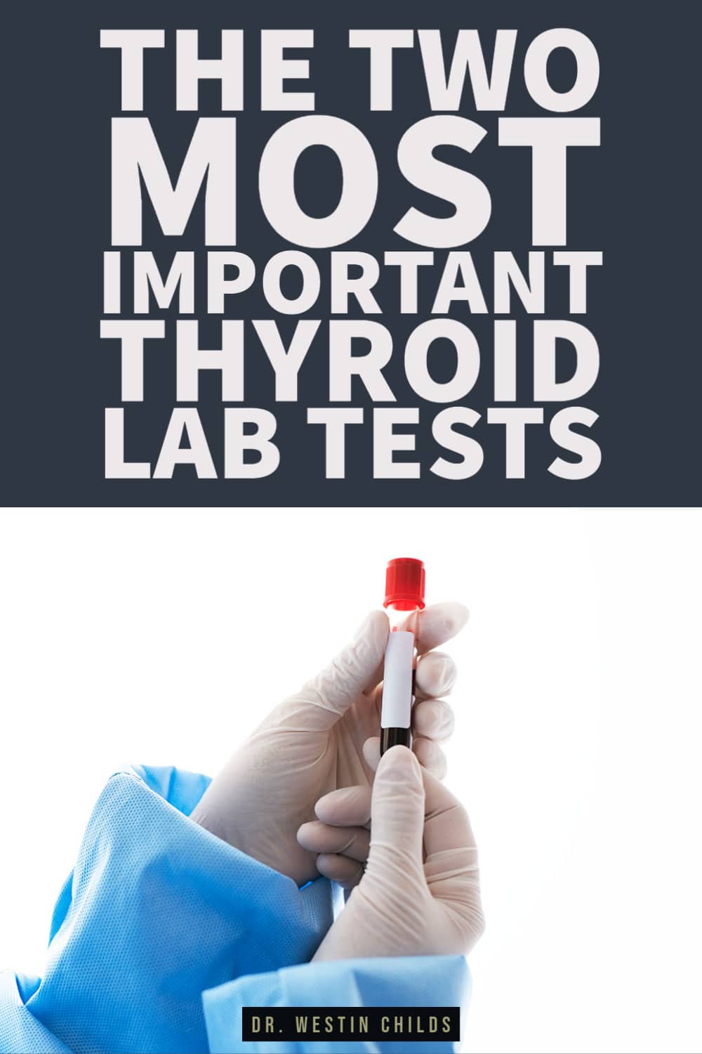 the two most important thyroid lab tests the two most important thyroid lab tests