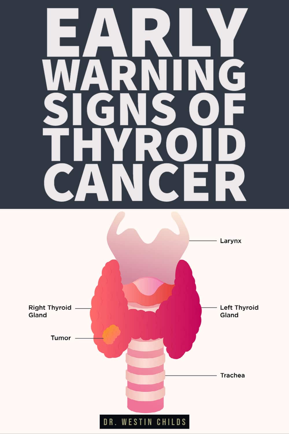 thyroid cancer presents with these warning signs thyroid cancer presents with these warning signs
