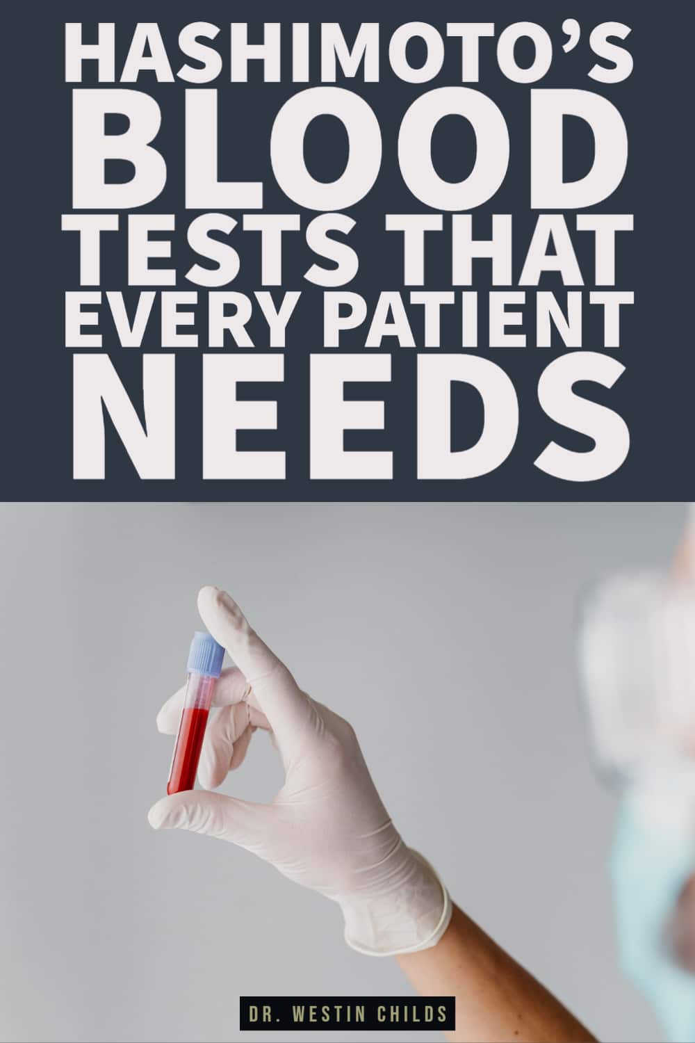 hashimoto's blood tests that ever patient needs hashimoto's blood tests that ever patient needs