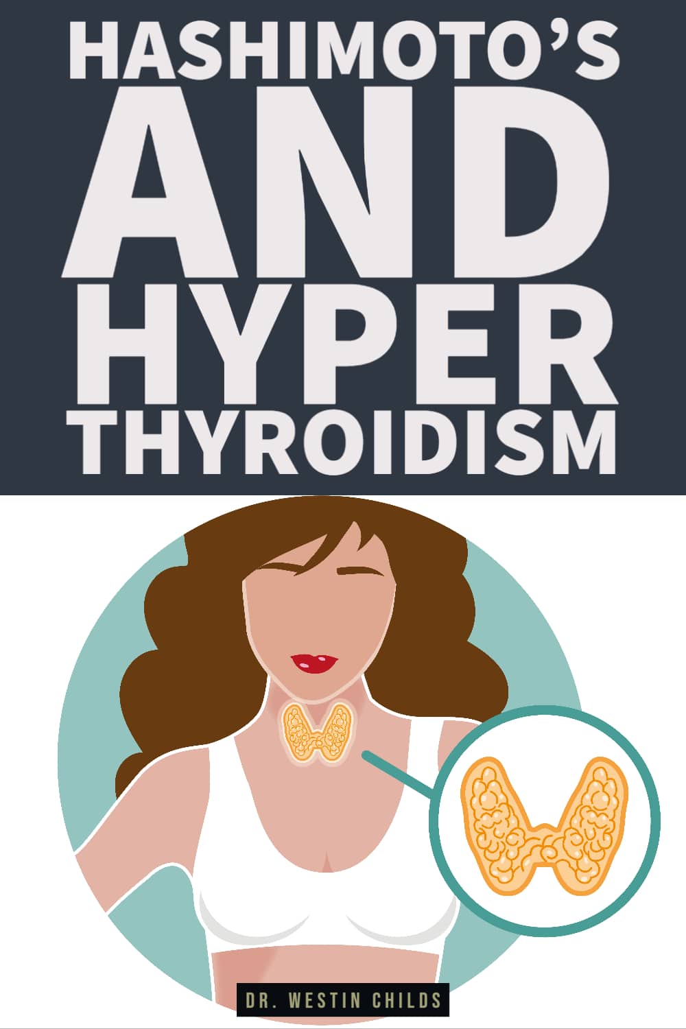how hashimoto's can lead to hyperthyroidism how hashimoto's can lead to hyperthyroidism