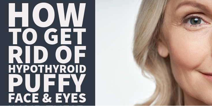How to Get rid of Hypothyroid Puffy Face & Eyes